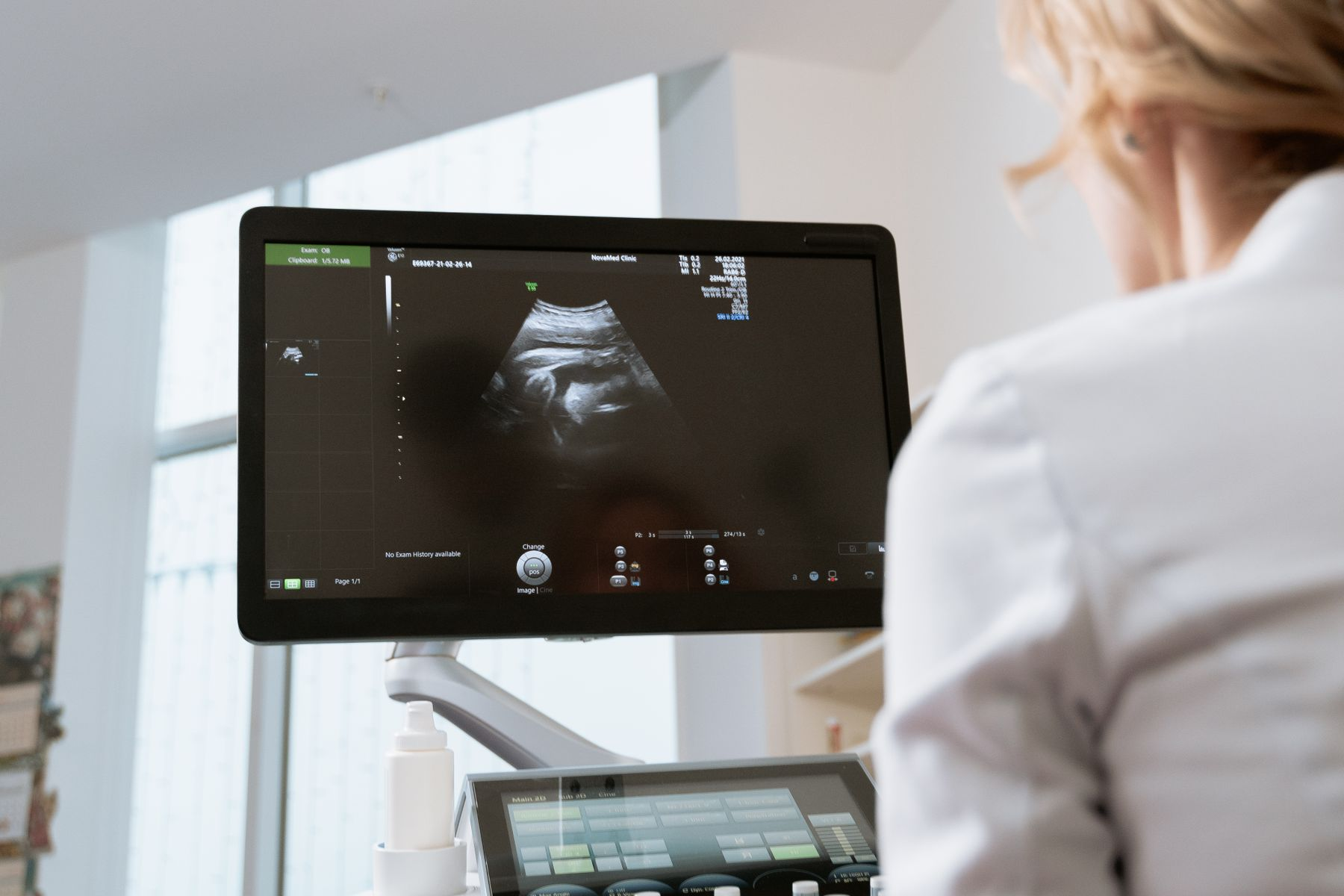 Photographie d’illustration d’une professionnelle de santé devant un écran d’échographie